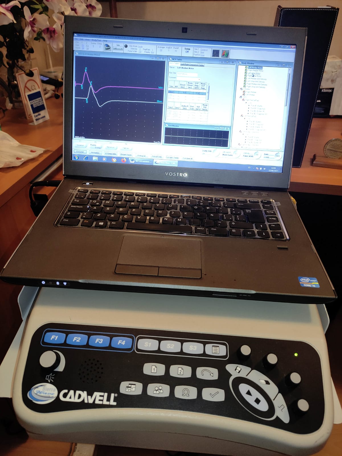 Estudios de Electromiografía en Toluca y Metepec